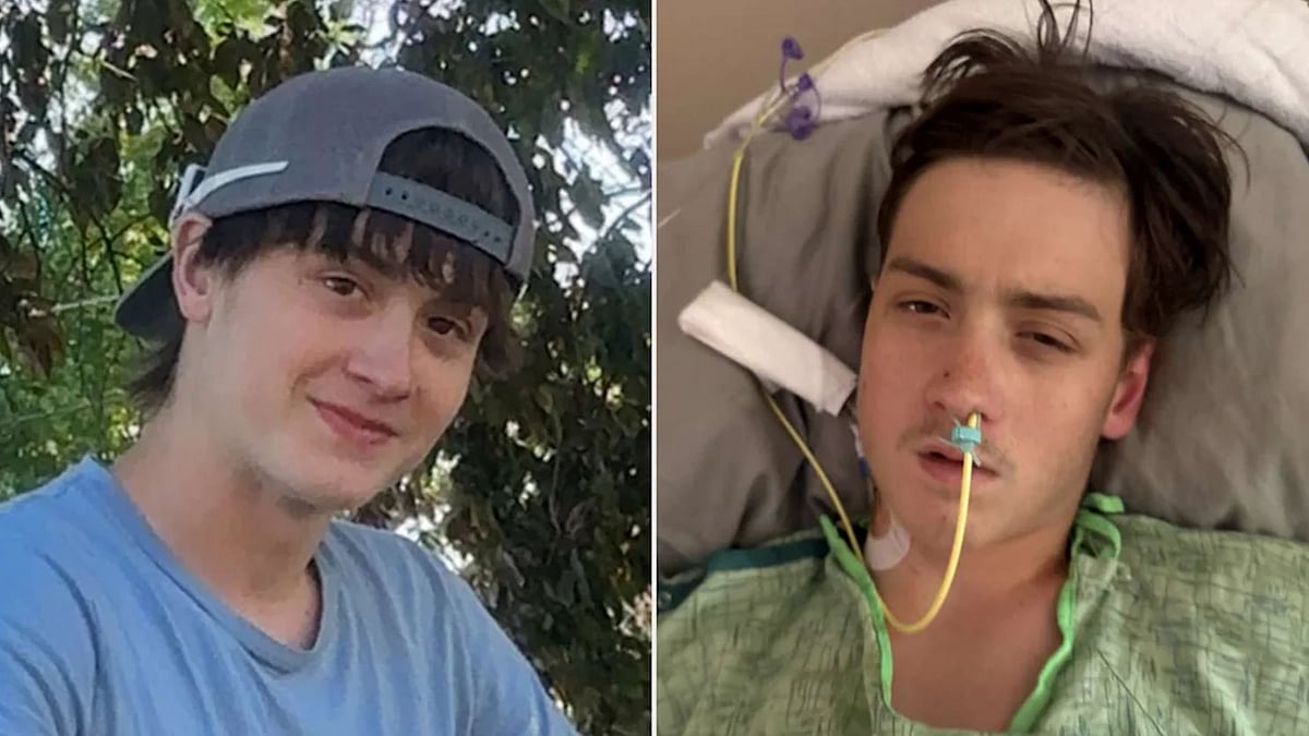 US: சிலந்தி கடித்ததால் சிறுநீரகம் செயலிழப்பு; உயிருக்கு போராடும் 16 வயது சிறுவன்!