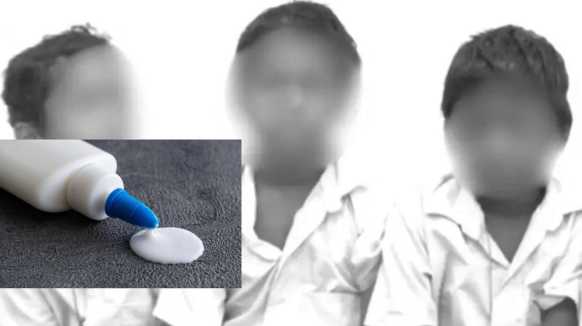 தூங்கிக் கொண்டிருந்த மாணவர்களின் கண்களை பசையால் ஒட்டிய நண்பர்கள் - விடுதியில் நடந்த விபரீதம்