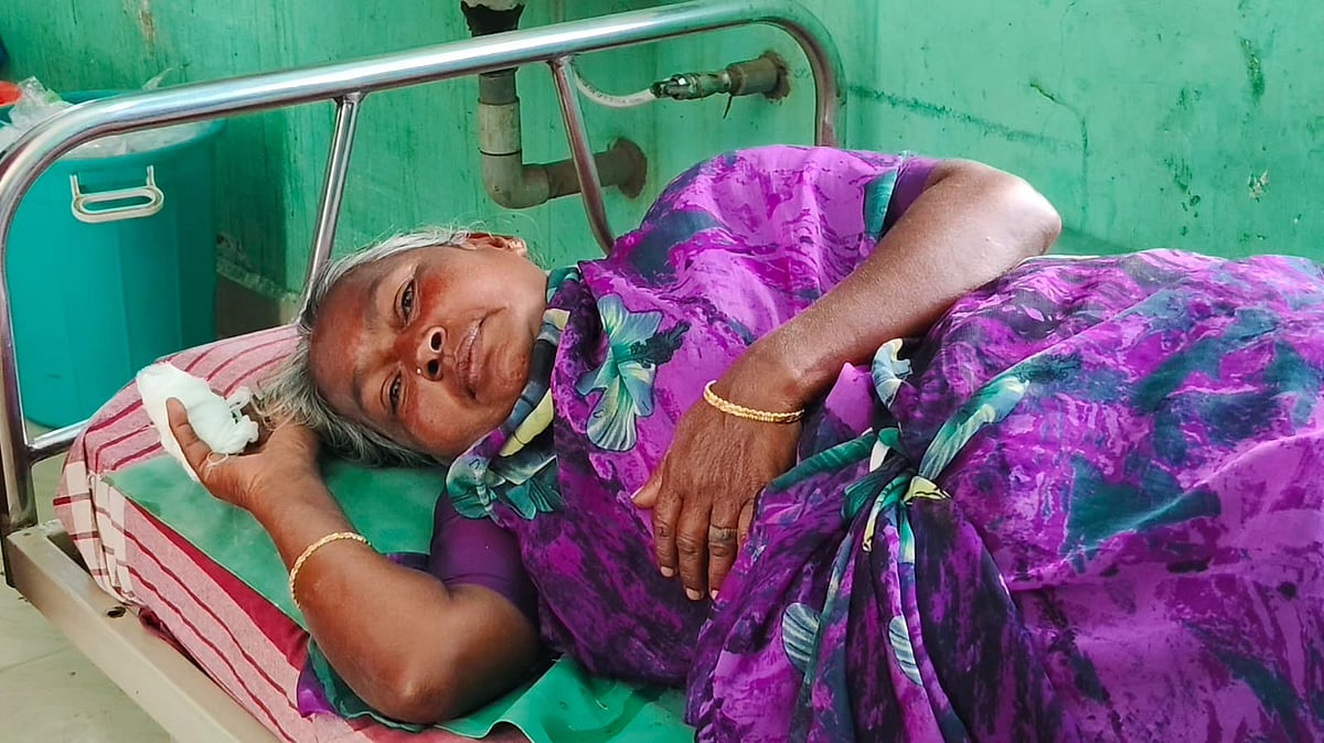 'தொடர் புகார்; கண்டுக்கொள்ளாத நகராட்சி' மூதாட்டியின் கைவிரலை கடித்து துண்டாக்கிய தெரு நாய் 
