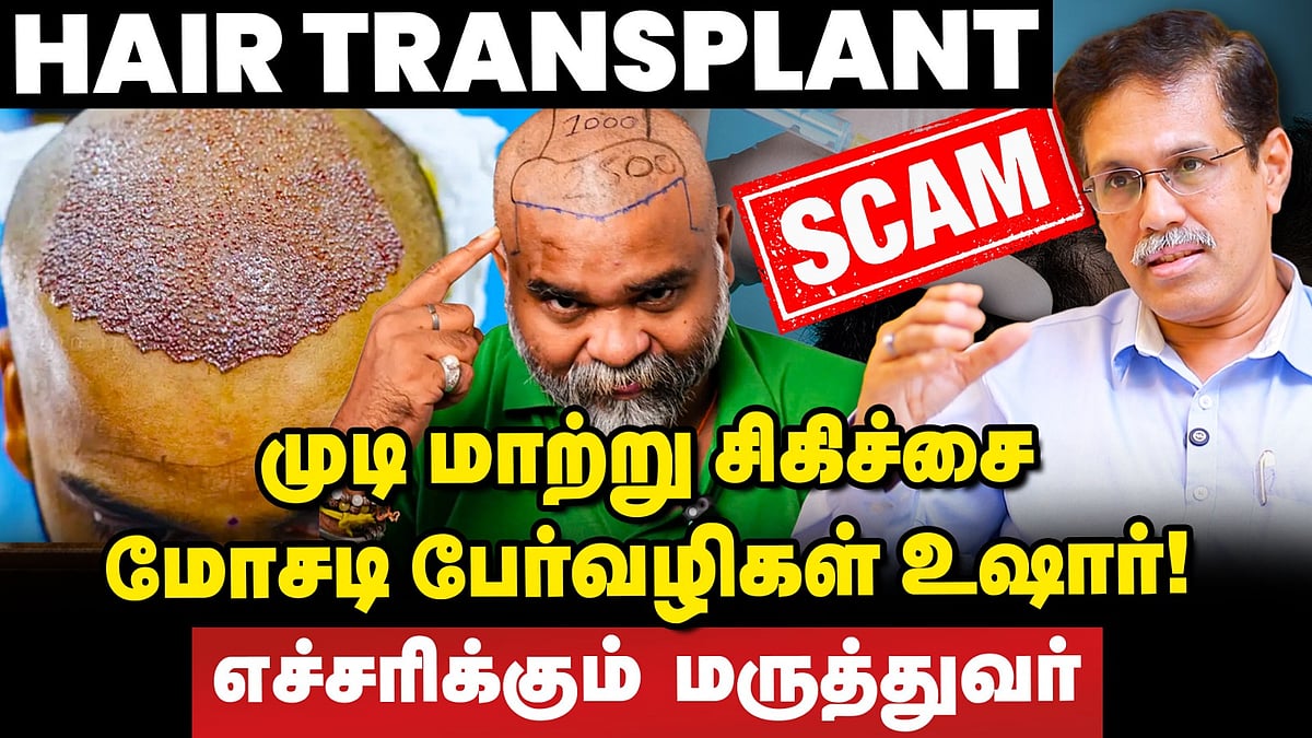Hair Transplant Scam: முடிக்காக உயிரை பணையம் வைக்காதீர்கள் | எச்சரிக்கும் மருத்துவர்