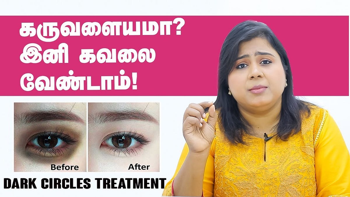 Tips To Remove Black Circles Around Eyes In Tamil Makeupview.co