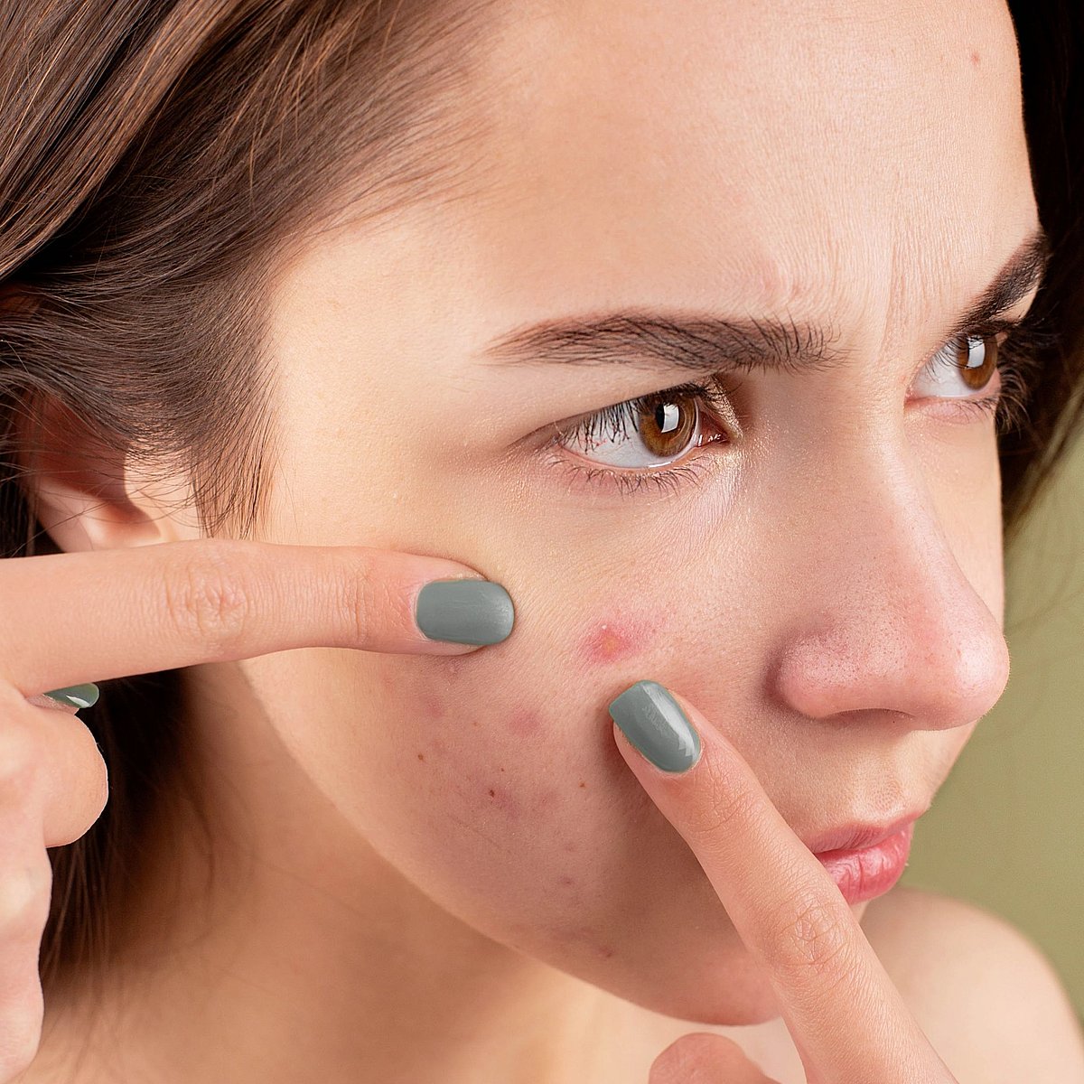 Pimple free face: முகப்பரு இல்லாத முகத்துக்கு சில டிப்ஸ்!