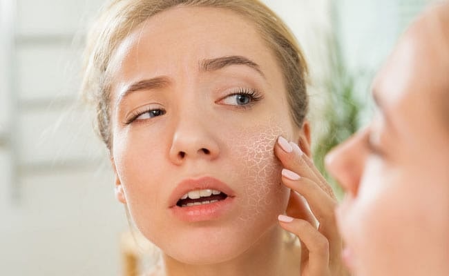 Tretinoin: டிரெண்டிங்கில் இருக்கும் ட்ரெடினோயின் கிரீம்; மருத்துவர் எச்சரிப்பது என்ன?