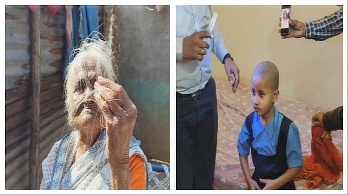 மகாராஷ்டிரா: கையோடு வரும் தலை முடி; ஒரே வாரத்தில் வழுக்கை; அச்சத்தில் கிராம மக்கள்; அரசு சொல்வதென்ன?