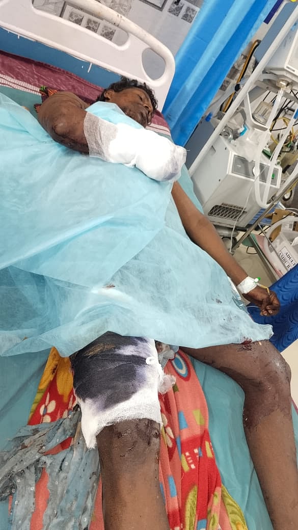திடீரென வெடித்து சிதறிய பட்டாசு - துண்டு துண்டான பொள்ளாச்சி விவசாயியின் கை விரல்கள்... என்ன நடந்தது?