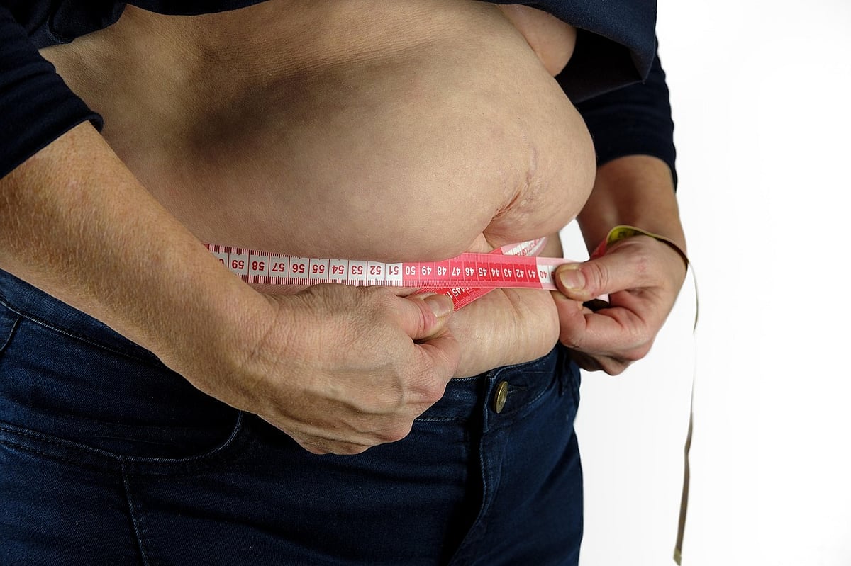 Obesity: எவை எல்லாம் உங்களை `வெயிட்டாக்கும் தெரியுமா? - மருத்துவர் விளக்கம்
