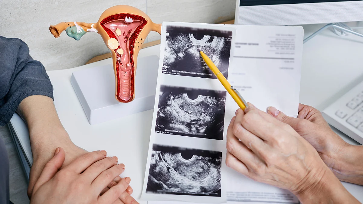 Gynaecology