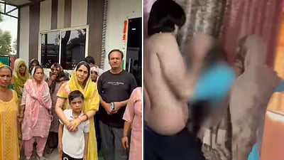 UP வரதட்சணை கொடுமை: அம்மா மீது தீ வைத்தனர் - குழந்தை கண்முன் தாயை எரித்து கொன்ற கணவர் குடும்பம்