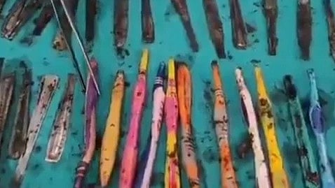 வயிற்றிலிருந்து எடுக்கப்பட்ட பொருள்கள்