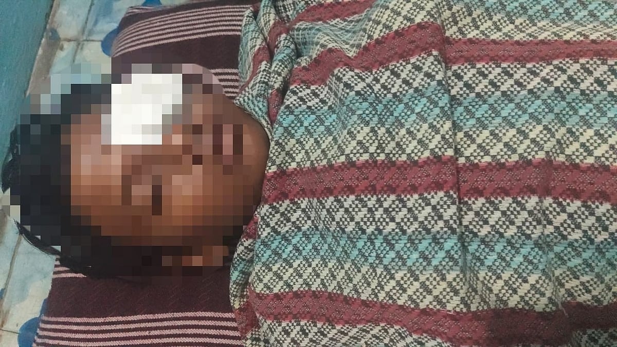 கண்பார்வை இழந்த மாணவன் 