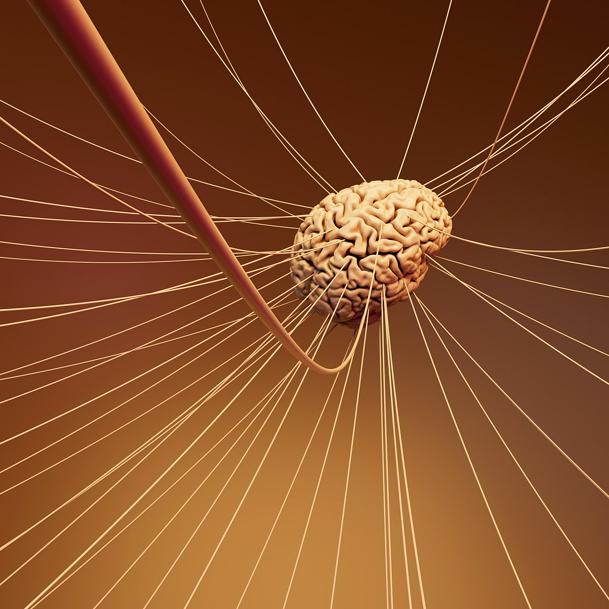 இந்தியாவில்-முதன்முறை;-`அடாப்டிவ்-டீப்-பிரெயின்-ஸ்டிமுலேஷன்-சென்னை-அபோலோ-மருத்து