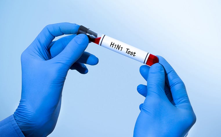 தேசிய அளவில் அதிகரிக்கும் H1N1 காய்ச்சல் பாதிப்பு - சுகாதாரத்துறை தீவிர கண்காணிப்பு!