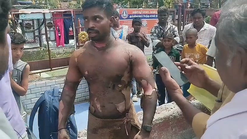 இளம் பெண் காதலிக்க மறுத்ததால் தீ வைத்துக் கொண்ட சுமன்ராஜ்