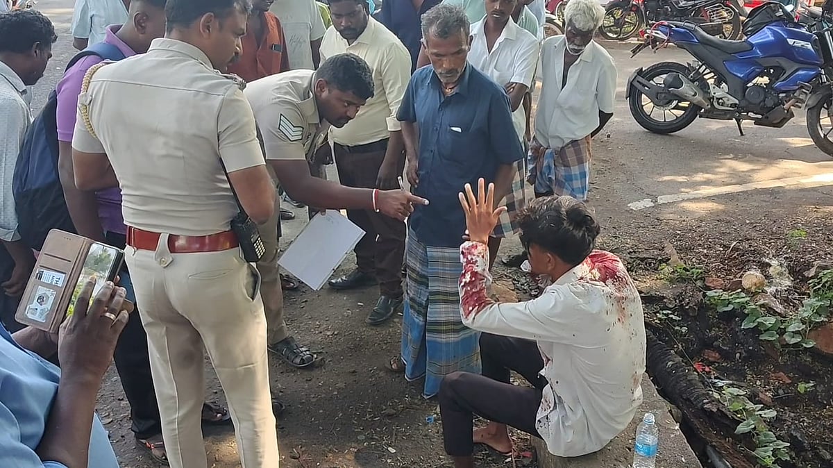 மதுரை கல்லூரி மாணவருக்கு அரிவாள் வெட்டு